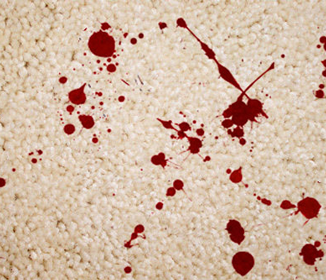  photo removing-blood-stains-on-carpet_zps03d9fcd8.png